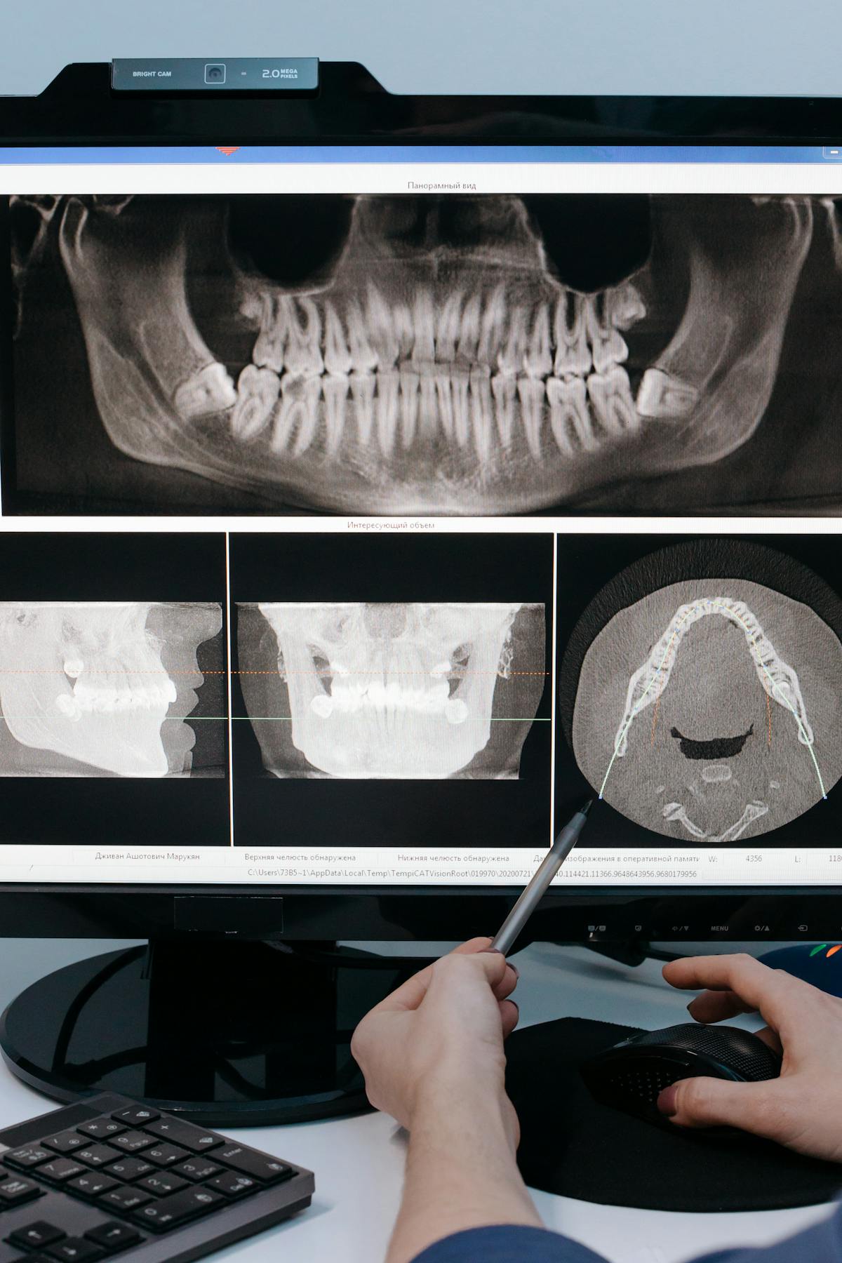 Panoramic dental X-ray (OPG) and CBCT views on screen — the radiographs Dentospire's AI reads